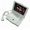 laptop Ultrasound scanner